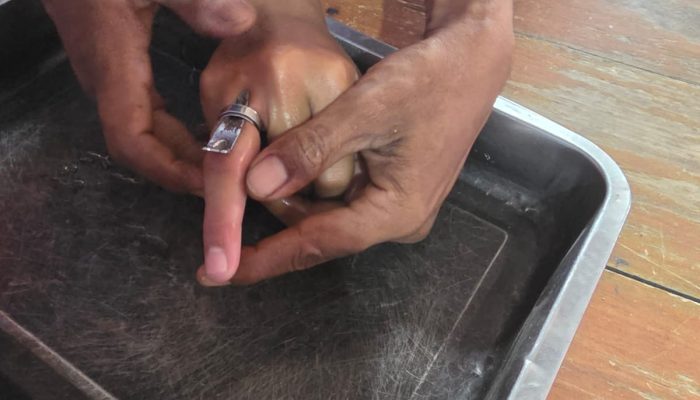 Damkarmat Kendari Berhasil Evakuasi Cincin di Jari Siswa dalam Waktu 10 Menit